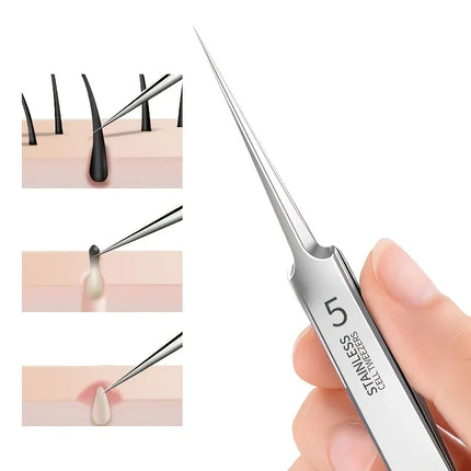 Cellular Acne Blackhead Tweezers